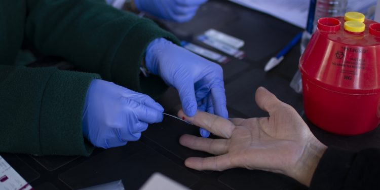 Concientizarán sobre las Hepatitis Virales